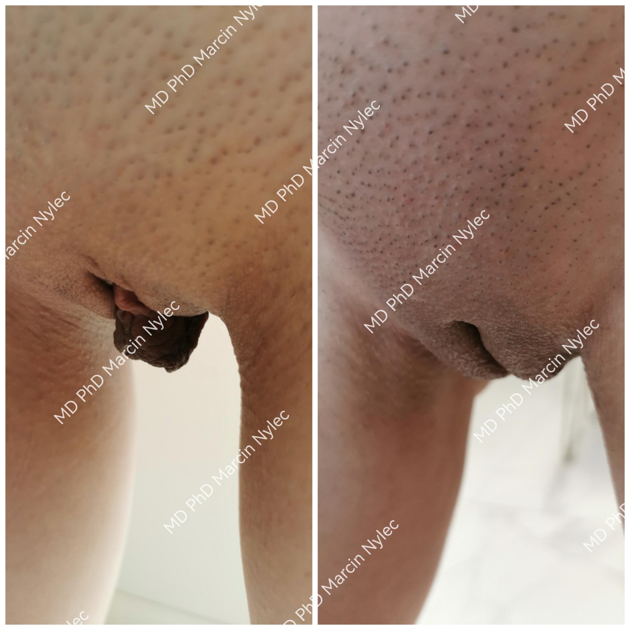 Transformation from aesthetic surgery - detailed photos.